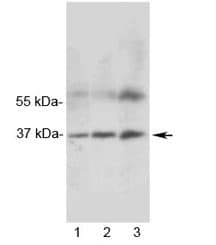 Polyclonal Rabbit anti-Rat MRGX1 / MRGPRX1 Antibody (IHC, WB)