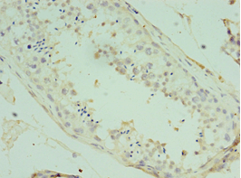 Polyclonal Rabbit anti-Human ATF7 Antibody (aa1-117, IHC, WB)