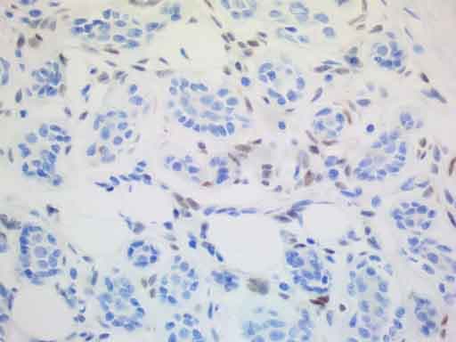 ALX4 Antibody (clone UMAB118)
