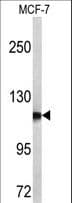 Polyclonal Rabbit anti-Human NPEPPS Antibody (aa709-737, IHC, WB)