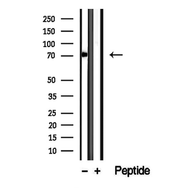 CCDC22 Antibody