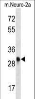 CDK1 / CDC2 Antibody (aa269-297)