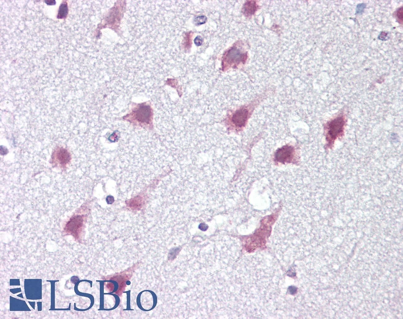 IHC-plus™ ZMYM3 Antibody