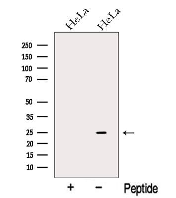 NDUFAF2 / NDUFA12L Antibody