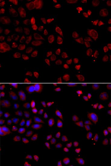 SLC22A11 Antibody