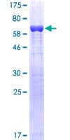 Human GMDS / GMD Protein (Recombinant GST)
