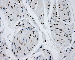 RPA2 / RFA2 / RPA34 Antibody (clone OTI9A1)