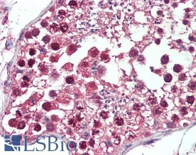 IHC-plus™ UBE1L2 / UBE1L2 Antibody (aa1-50)