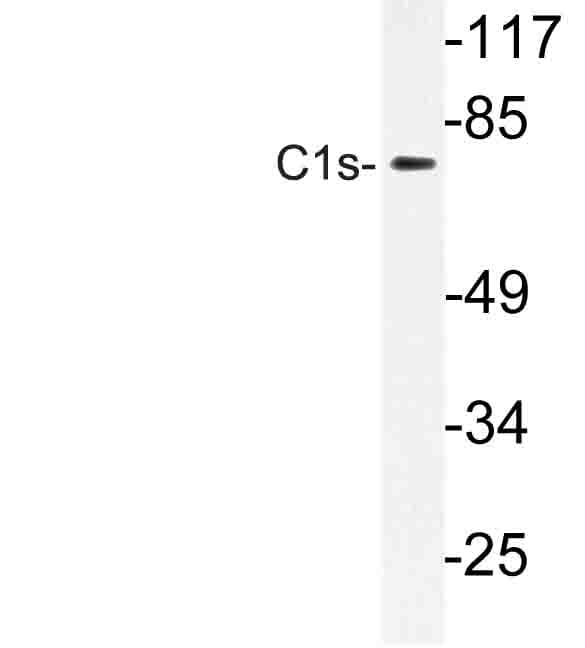 Complement C1s Antibody (Lys583)