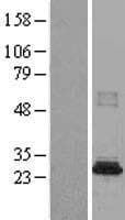 NAT8B Protein (Over-Expression Lysate Myc-DDK (Flag))