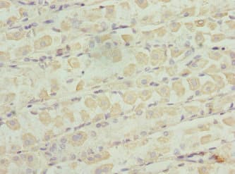 Polyclonal Rabbit anti-Human ZNF324 / ZF5128 Antibody (IHC, WB)