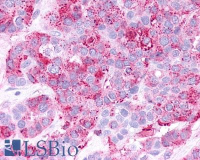PathPlus™ Polyclonal Rabbit anti-Human CRHR2 / CRF2 Receptor Antibody (Extracellular Domain, IHC)