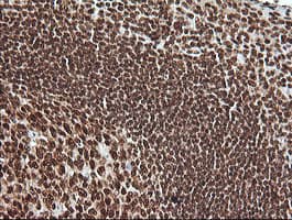 MAPK4 / ERK4 Antibody (clone OTI2D7)