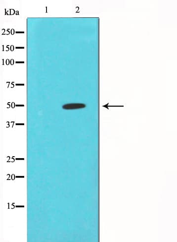 CORO1A / Coronin 1a Antibody