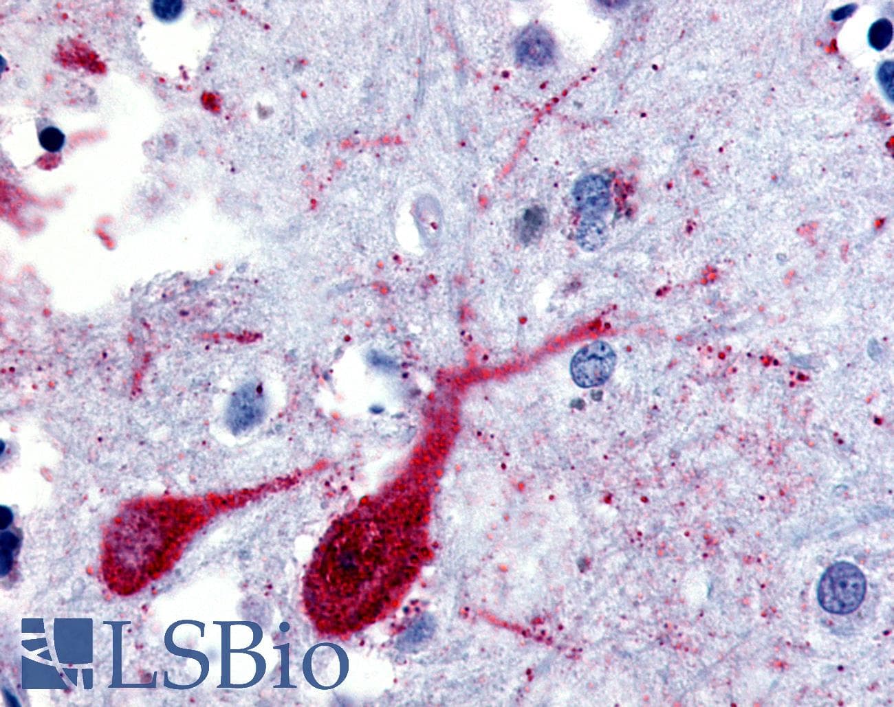 IHC-plus™ SLC5A9 / SGLT4 Antibody (Cytoplasmic Domain)
