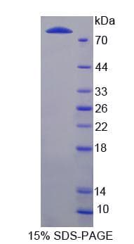 Rat LBP Protein (Recombinant His-GST)