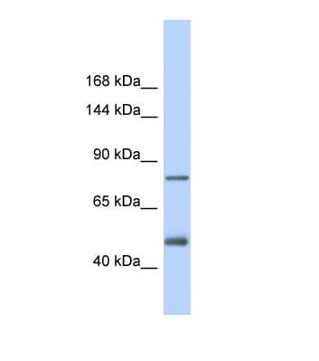 LDLR / LDL Receptor Antibody (aa451-500, FITC)