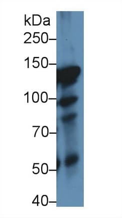 ITIH4 Antibody (aa478-722)