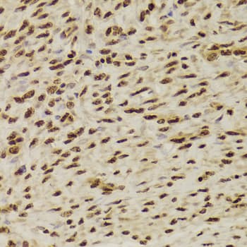 PHAP1 / ANP32A Antibody