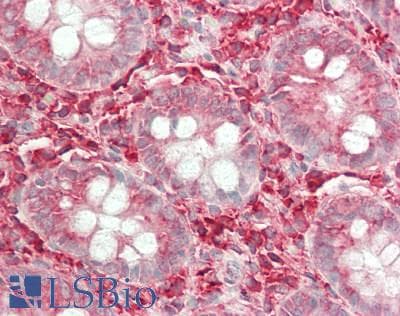 IHC-plus™ Polyclonal Rabbit anti-Human PKN1 Antibody (aa246-285, IHC, IF, WB)