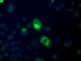H6PD / G6PDH Antibody (clone OTI2C12)