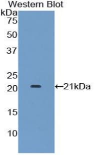 IFNA7 / Interferon Alpha 7 Antibody (aa24-189)