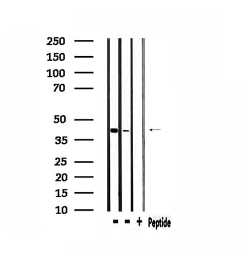 CKM / Creatine Kinase MM Antibody