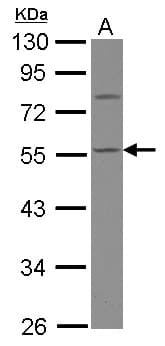 CASQ1 / Calsequestrin 1 Antibody