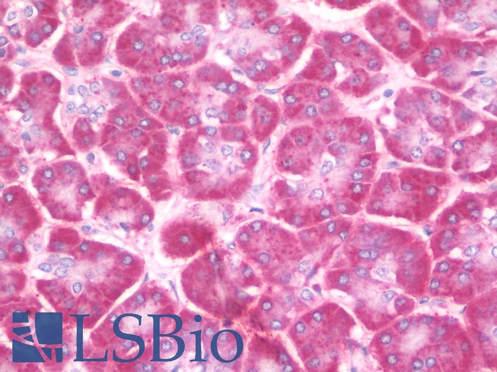 IHC-plus™ CEP290 Antibody (aa771-820)
