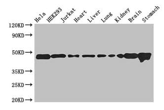 Polyclonal Rabbit anti-Human ASCC1 Antibody (IHC)