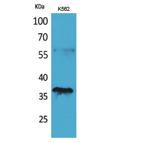 CD207 / Langerin Antibody (61-110 aa, Internal)