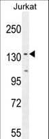 PPP1R3A / GM Antibody (aa754-782)