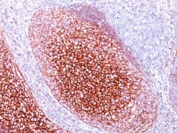 CR1 / CD35 Antibody (clone CR1/802, Ready-to-Use)