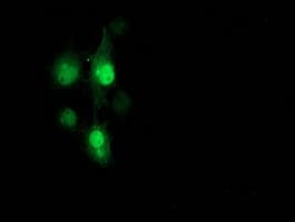 PNMT Antibody (clone OTI1B7)