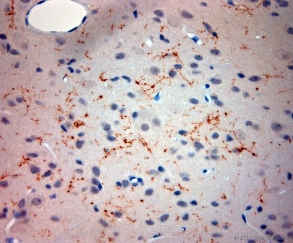 Polyclonal Rabbit anti-Rat SYNPO / Synaptopodin Antibody (aa890-930, IHC)