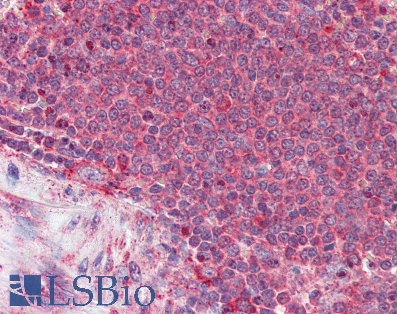 IHC-plus™ THBS1 / Thrombospondin-1 Antibody (aa19-32)