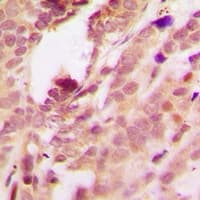 MAPK14 / p38 Antibody (phospho-Thr180/Tyr182)