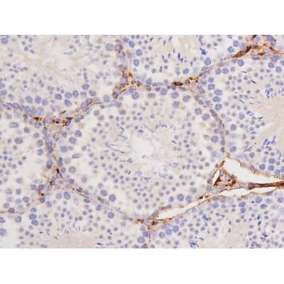 Polyclonal Rabbit anti-Human MAPT / Tau Antibody (phospho-Thr212, IHC, WB)