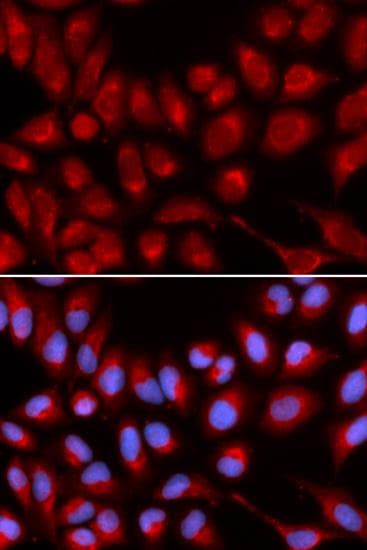 IL16 Antibody