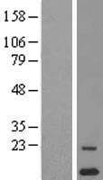 Human CYSTM1 / C5orf32 Protein (Over-Expression Lysate Myc-DDK (Flag))
