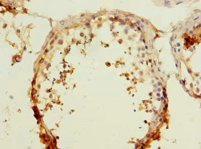 RAPGEF5 / GFR Antibody
