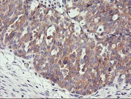 PHF21B Antibody (clone OTI3D1)