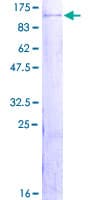 Human ZBTB48 / HKR3 Protein (Recombinant GST)