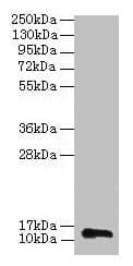 IHC-plus™ Polyclonal Rabbit anti-Human RPL36AL Antibody (IHC, WB)