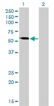 VRK2 Antibody (clone 3B10)