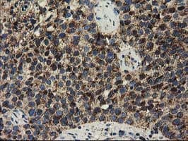 CLPP Antibody (clone OTI1C7)
