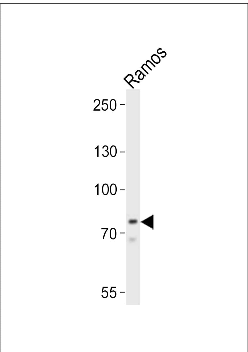 BTK Antibody (aa396-430)