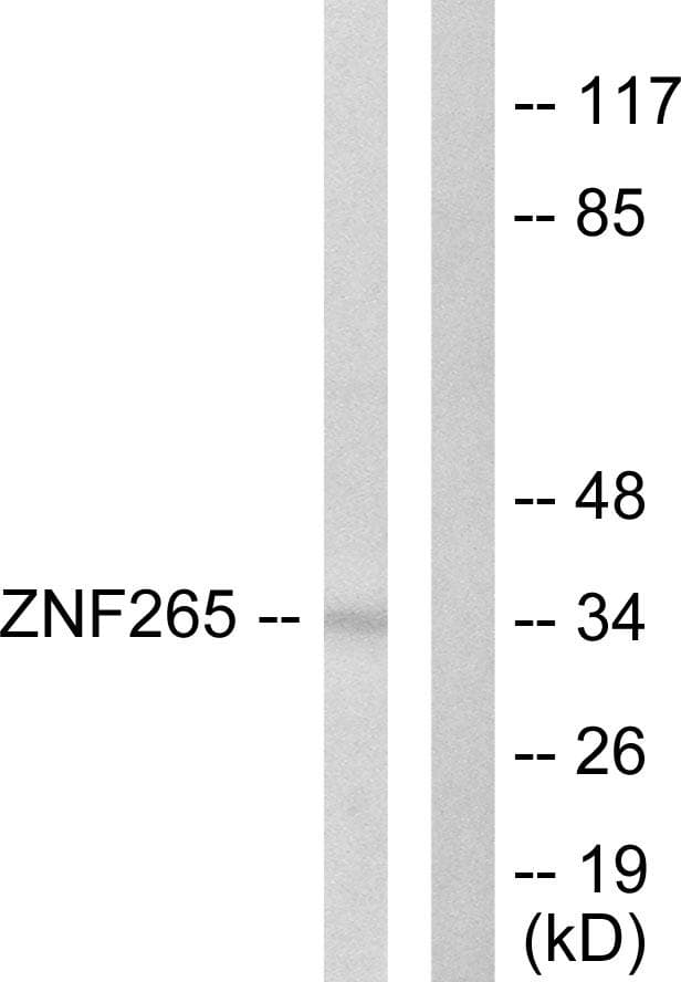 Polyclonal Rabbit anti-Human ZRANB2 / ZNF265 Antibody (IF, WB)