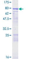 Human ENC1 Protein (Recombinant GST)