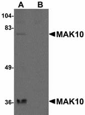 IHC-plus™ Polyclonal Rabbit anti-Human NAA35 Antibody (IHC, WB)